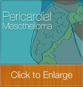 Pericardial Mesothelioma Chart